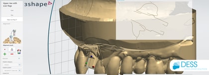 NT-Trading Scankörper für 3Shape DESS Dental Bibliotheken