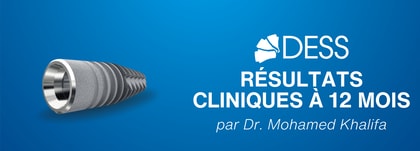 Suivi d’un an : les implants DESS® égalent les marques premium en stabilité osseuse marginale