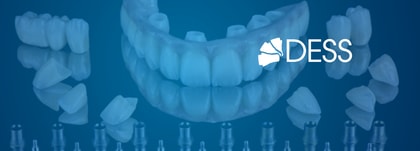 Ajuste pasivo en prótesis sobre implantes: cómo evitar desajustes en puentes implantosoportados