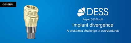 Implant divergence: from surgical limitation to prosthetic solution
