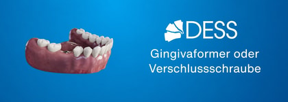 Gingivaformer oder Verschlussschraube: die wichtigsten Unterschiede bei Zahnimplantaten