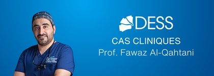 Prothèse fixe implanto-portée : cas clinique de réhabilitation full-arch avec DESS®