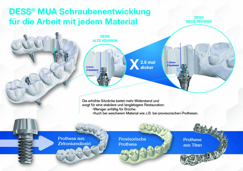 schraubenenentwicklung-fur-die-arbeit