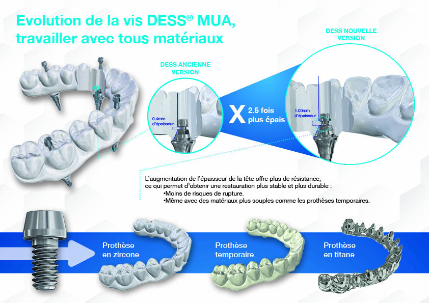 evolution-vis-dess-mua