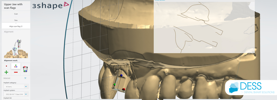 NT-Trading Scankörper für 3Shape DESS Dental Bibliotheken 