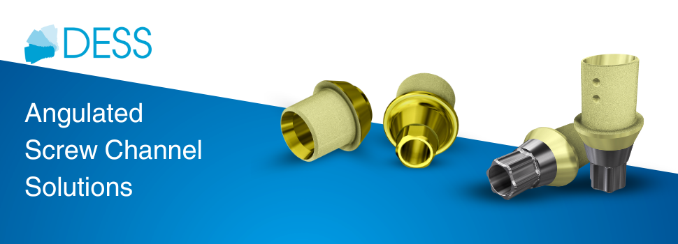 Benefits of Angulated Screw Channel Abutments