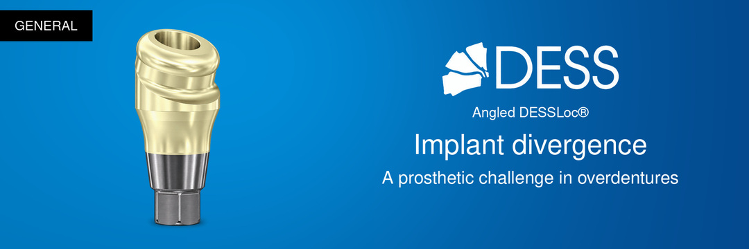 Angled DESSLoc® — implant divergence and the prosthetic challenge in overdentures