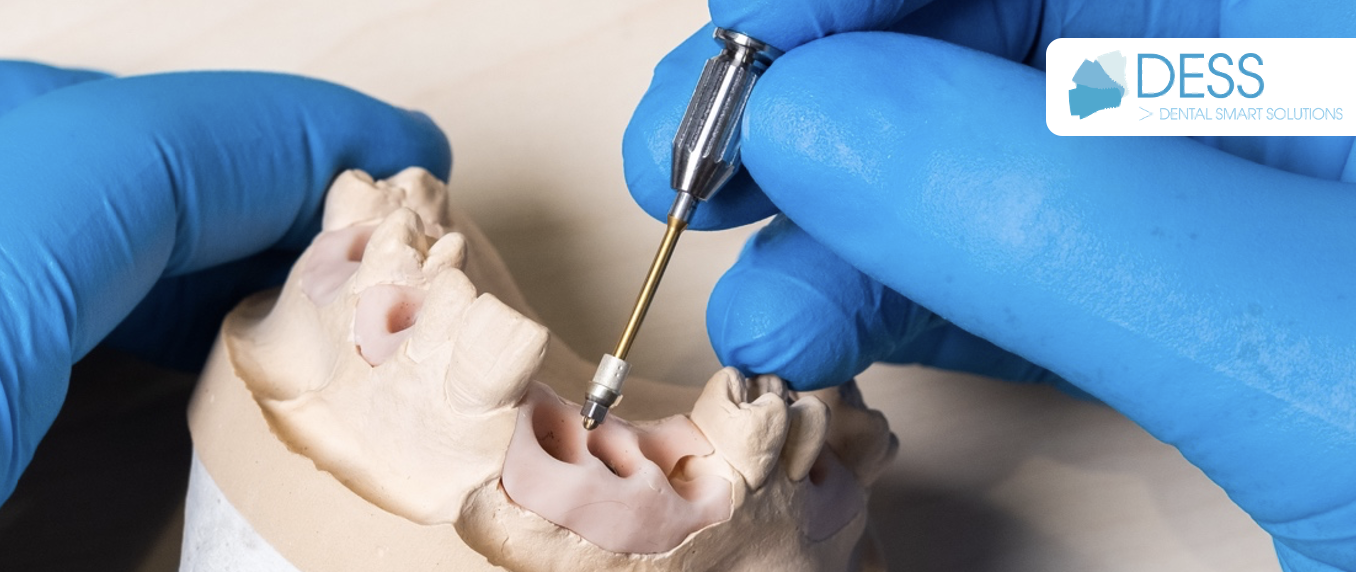 DESS Dental führt einen neuen Schraubendreher Griff für Zahnärzte ein