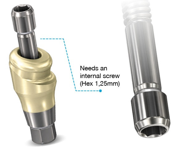 Angled DESSLoc® and its fixation screw with a 1.25 mm hexagonal interface