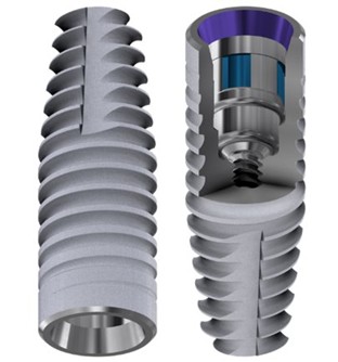 DESS® CONICAL BLT implant used in the full-arch rehabilitation
