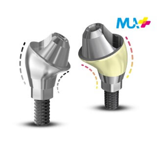 DESS® MUA+ Multi-Unit Abutments for full-arch implant restorations
