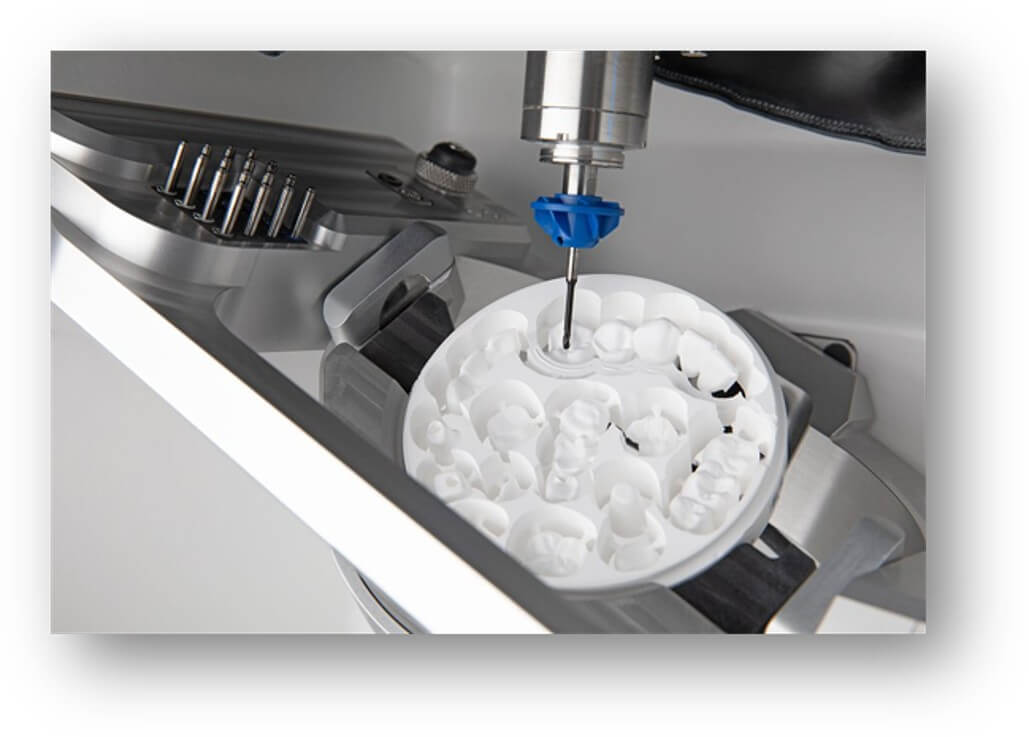 Dental milling machine producing an implant-supported restoration